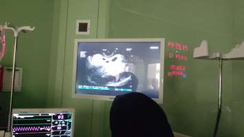 راه‌اندازی آندوسونوگرافی (EUS) در بیمارستان برکت؛ گامی نوین در خدمات تشخیصی پیشرفته